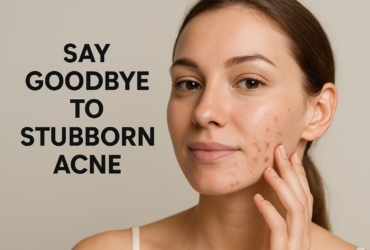 Clear Skin Starts Here: Why Isotretinoin 20mg Works Best