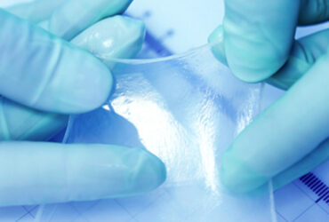 Amniotic Membrane Graft for Wounds and Tissue Healing