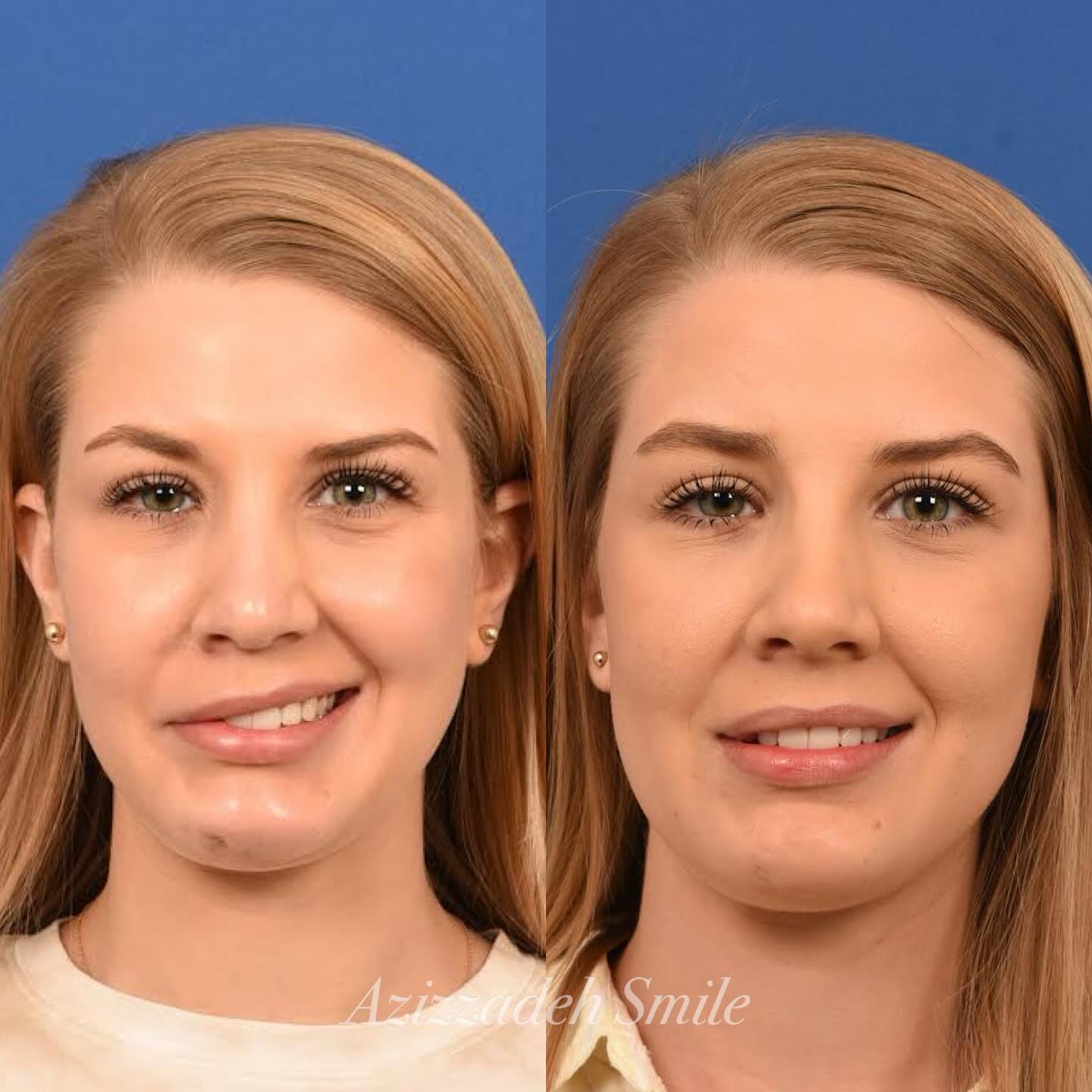 The Facial Paralysis Institute