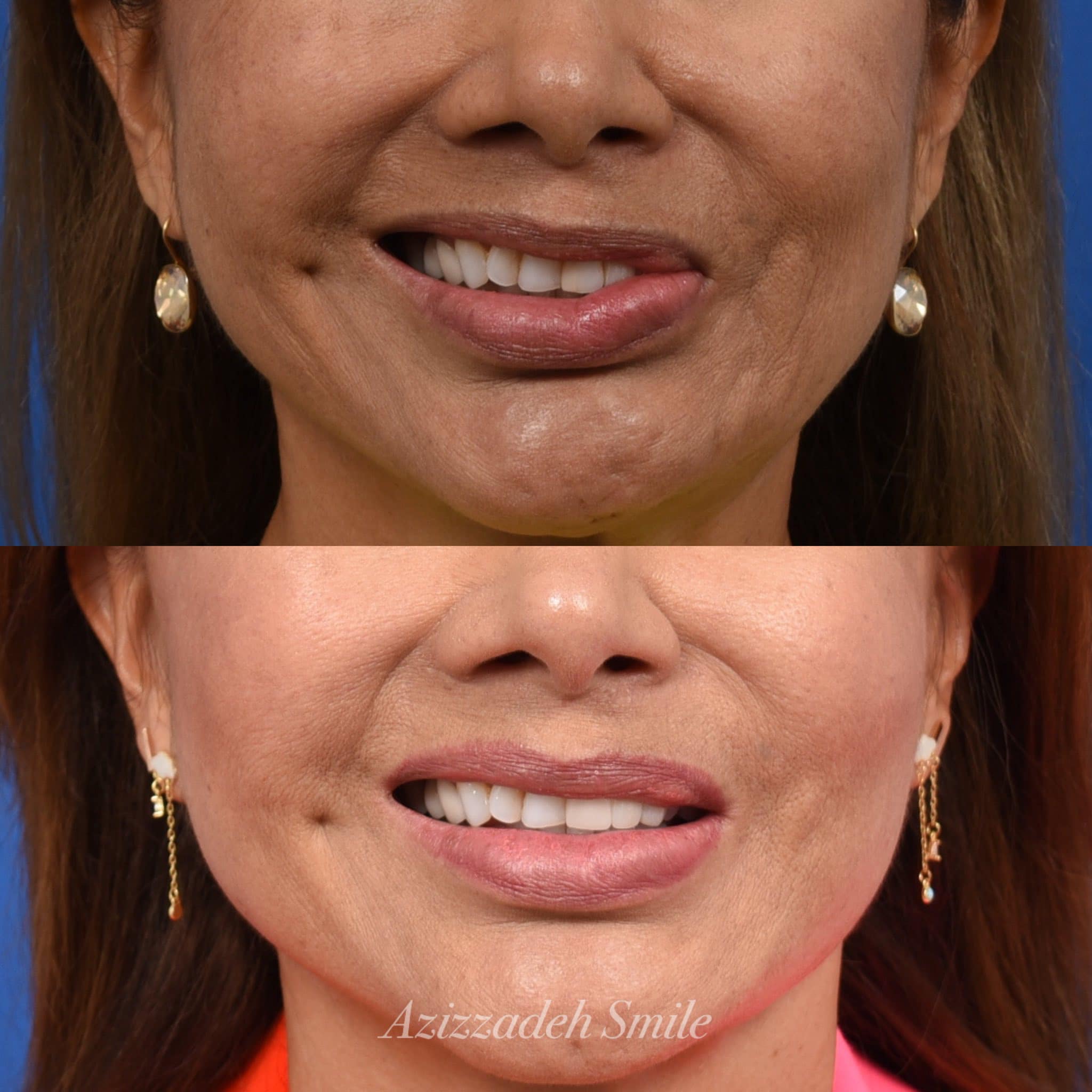 The Facial Paralysis Institute