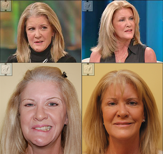 The Facial Paralysis Institute
