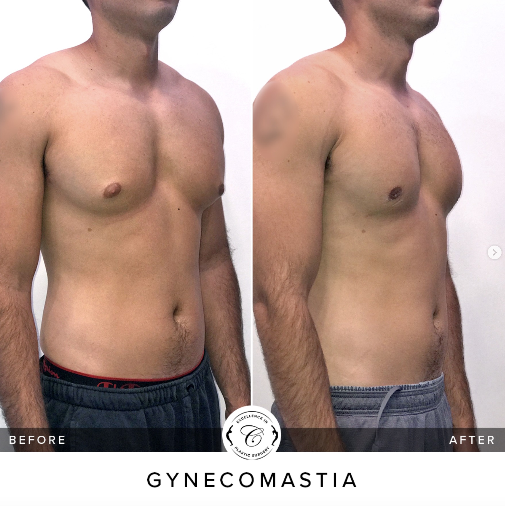 Cruise Plastic Surgery