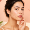 Doxycycline for Acne: Is It Safe?