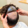 Looking for Hair Direct Wigs? Explore Quality Alternatives