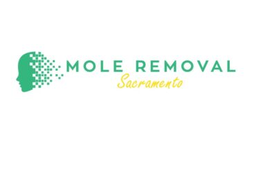Mole Removal Sacramento