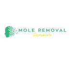 moleremovalsacramento