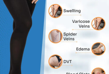 SNUG360 Thigh High Compression Stockings 15-20 mmHg – Full-Leg Comfort & Support